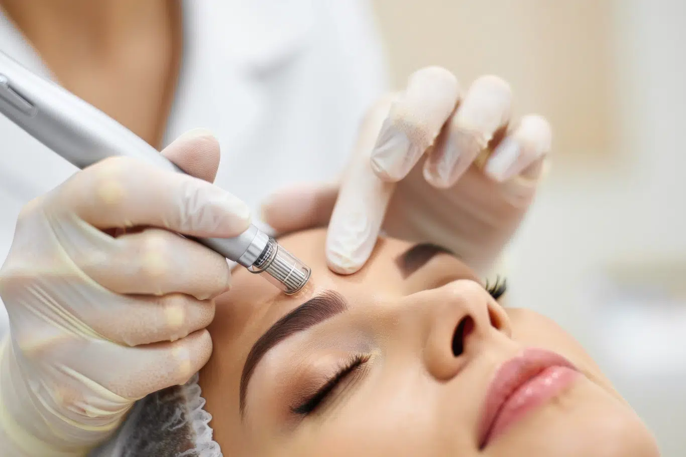 Close up of a professional cosmetologist performing microneedling treatment